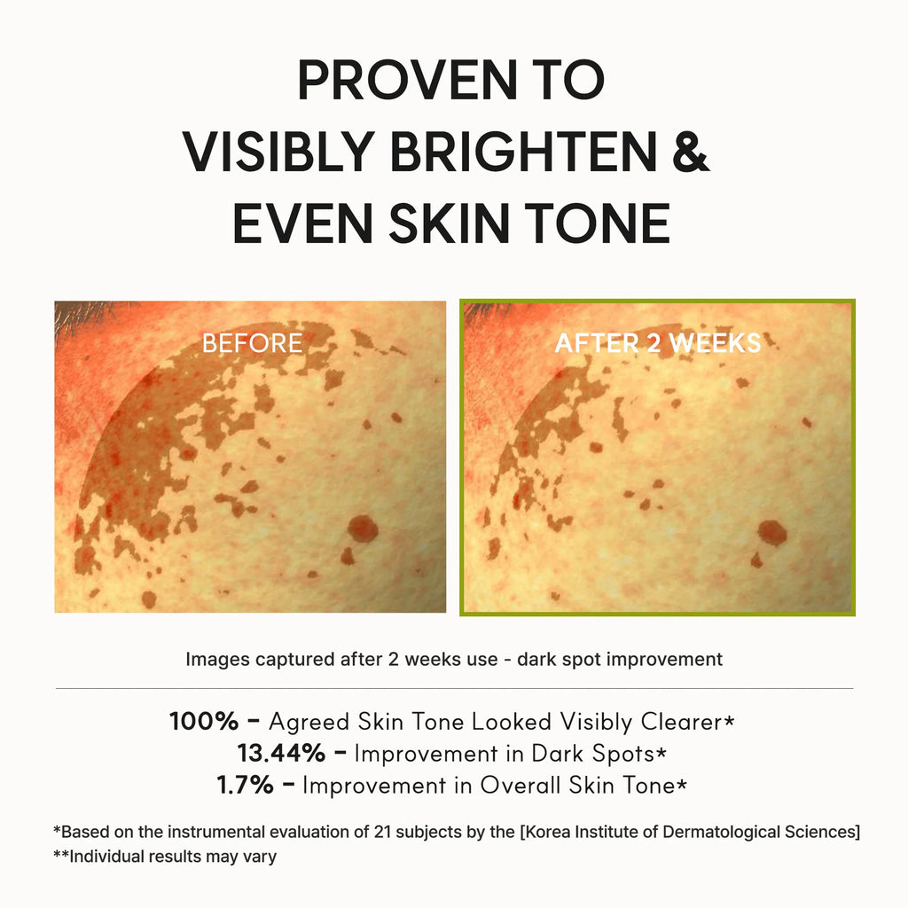 Arencia Vitamin C Booster Shot Serum – Glutathione, Niacinamide & Vitamin E for Dark Spots, Fine Lines & Wrinkles | Korean Skincare, Glass Skin, 30ml/1.01 fl.oz