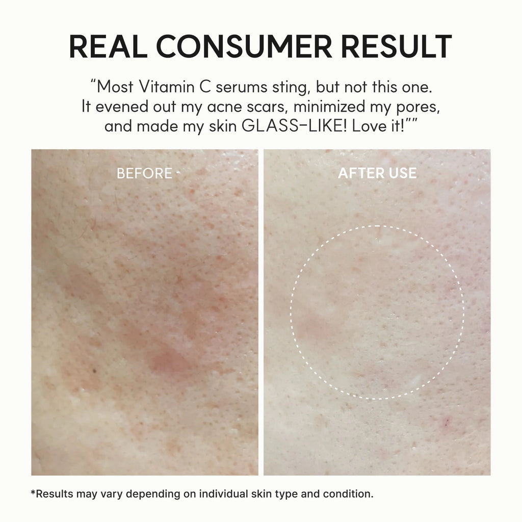 Arencia Vitamin C Booster Shot Serum – Glutathione, Niacinamide & Vitamin E for Dark Spots, Fine Lines & Wrinkles | Korean Skincare, Glass Skin, 30ml/1.01 fl.oz