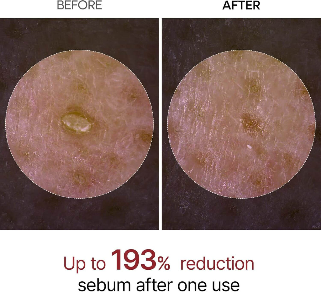 Dr.Melaxin Peel Shot Exfoliating White & Black Rice Ampoule Essence