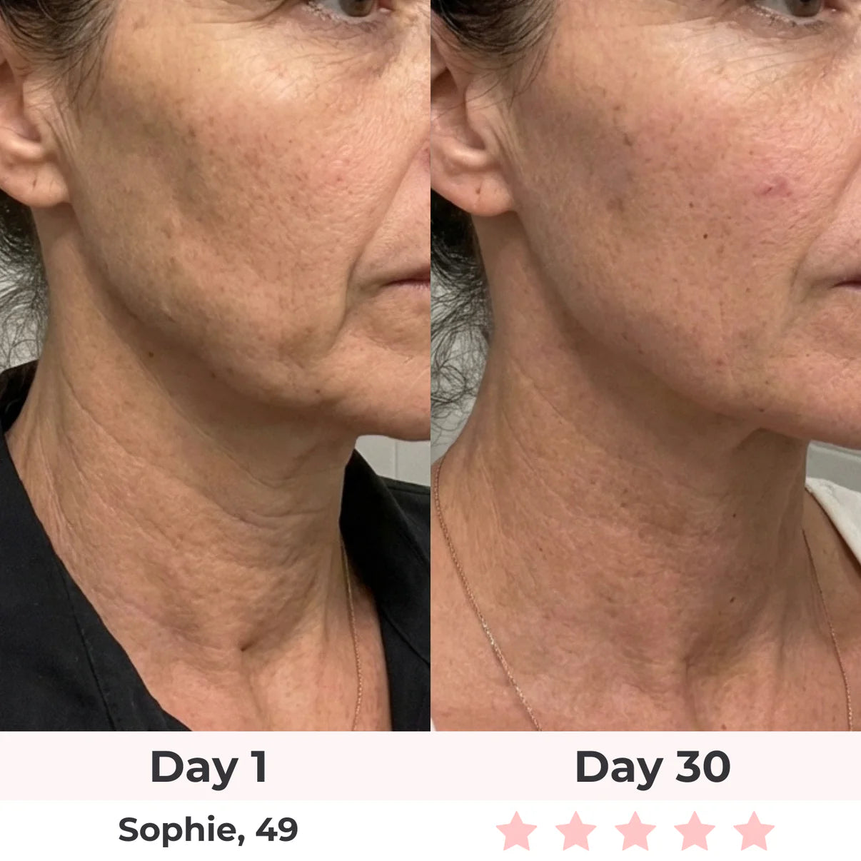 LEV 7-in-1 LED Facial Sculptor