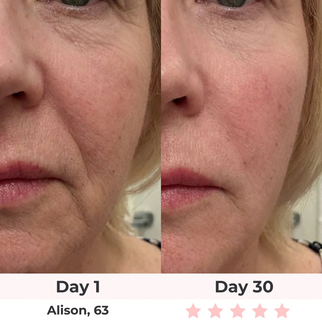 LEV 7-in-1 LED Facial Sculptor