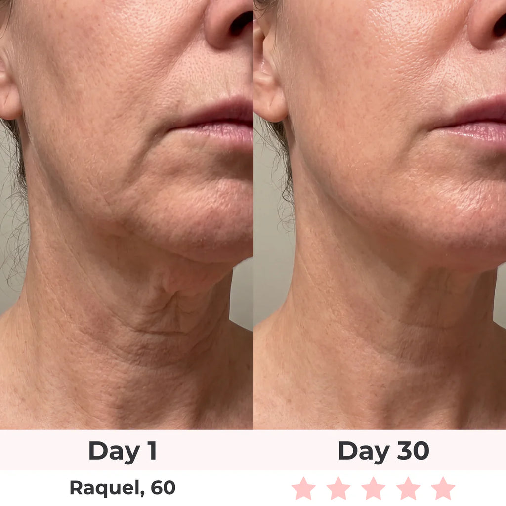 LEV 7-in-1 LED Facial Sculptor