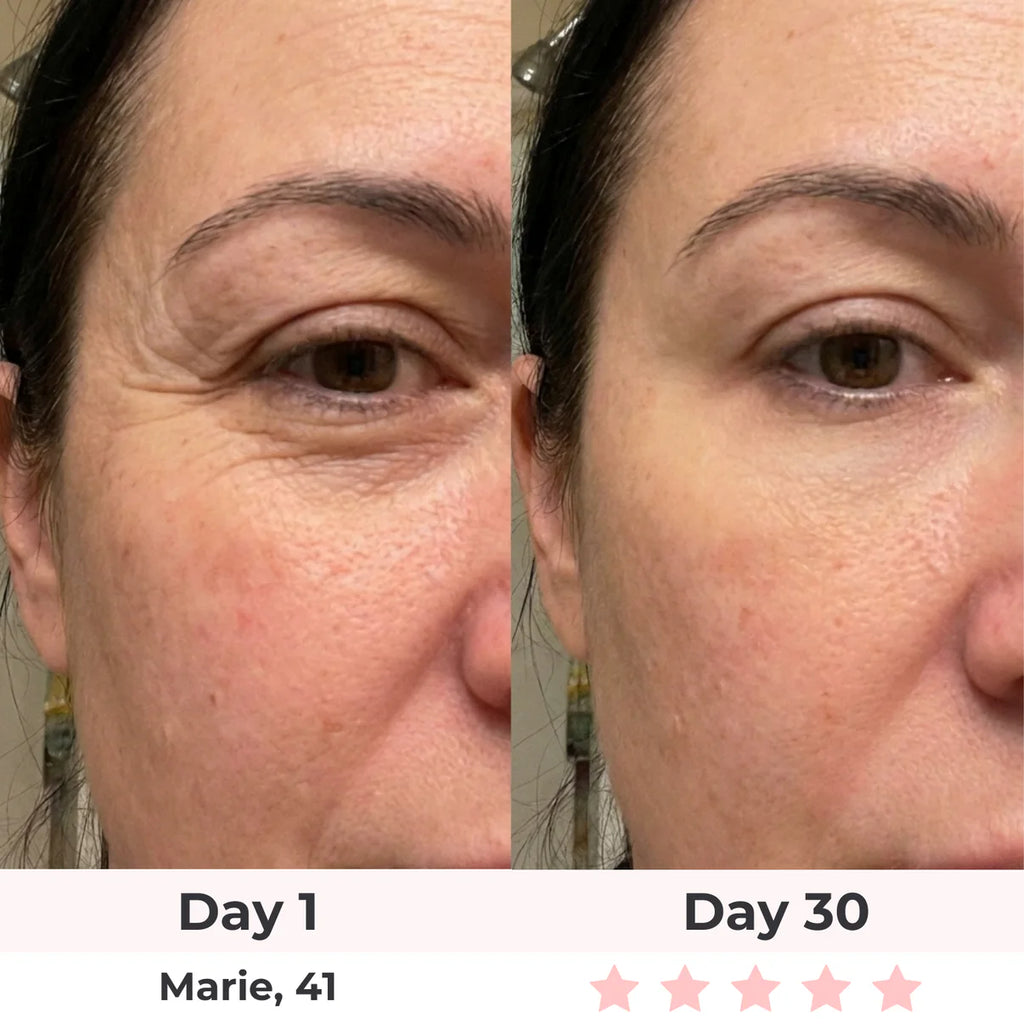 LEV 7-in-1 LED Facial Sculptor