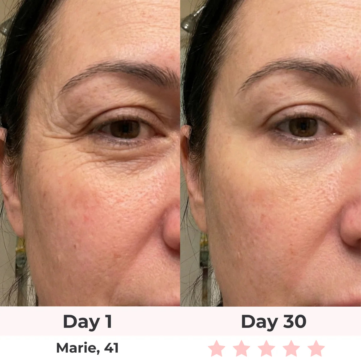 LEV 7-in-1 LED Facial Sculptor