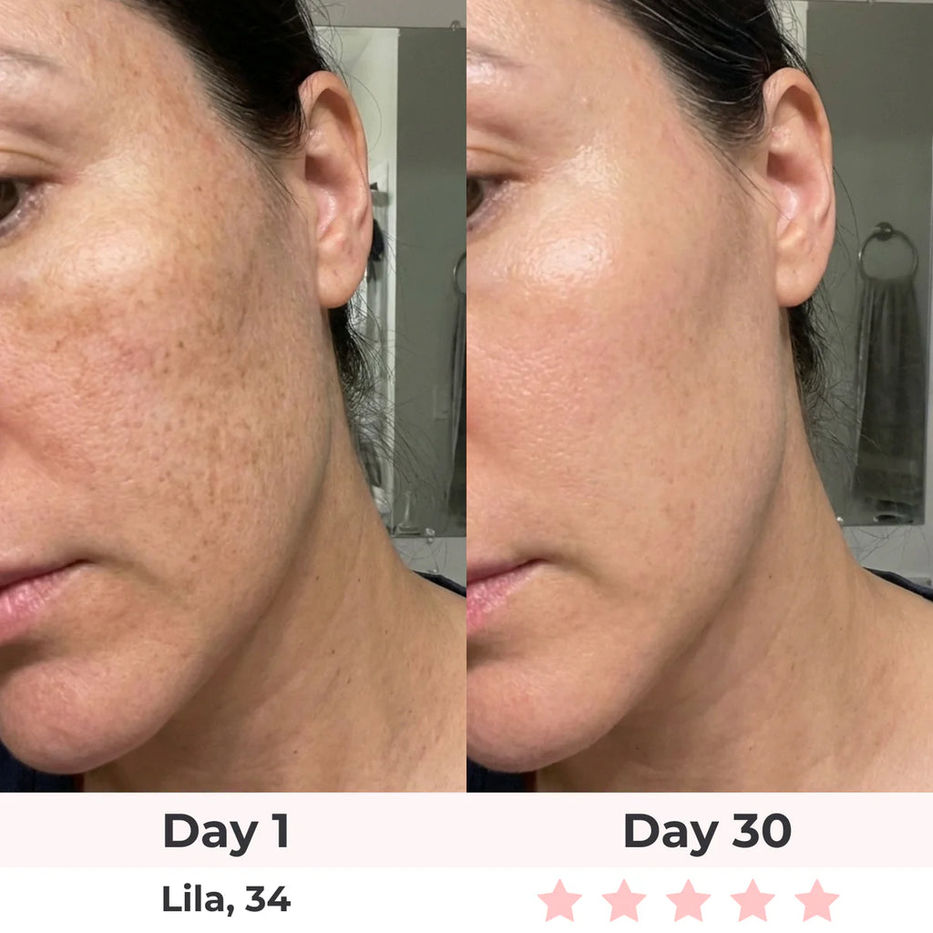 LEV 7-in-1 LED Facial Sculptor